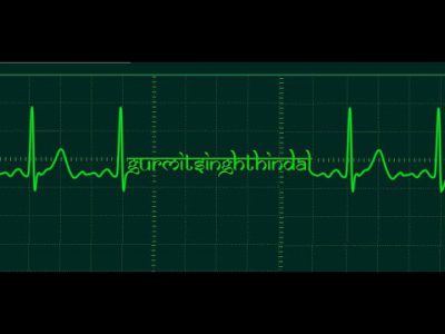 dj scratch (epmd) some breaks n history./.DJ Scratch on 107.5 WBLS